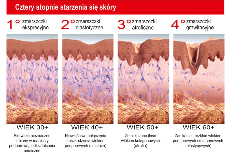4 stopnie starzenia sk&oacute;ry